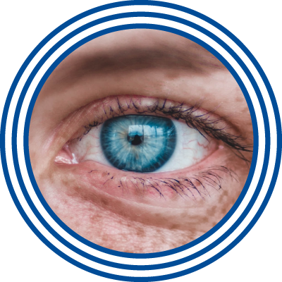 Stewart Optical Eye Emergencies